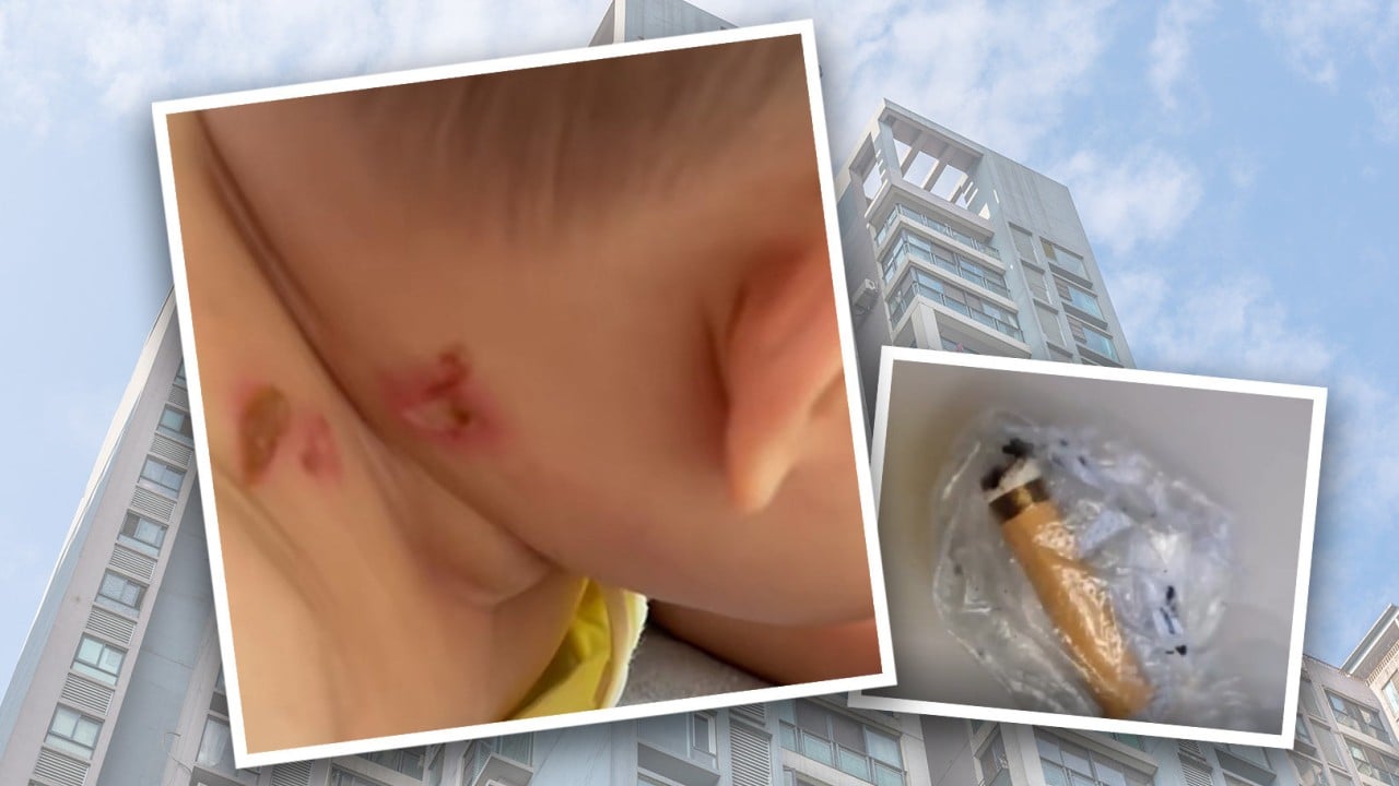 ‘Heartbreaking’: careless China smoker whose tossed-away cigarette butt burned 4-month-old baby tracked down using DNA testing