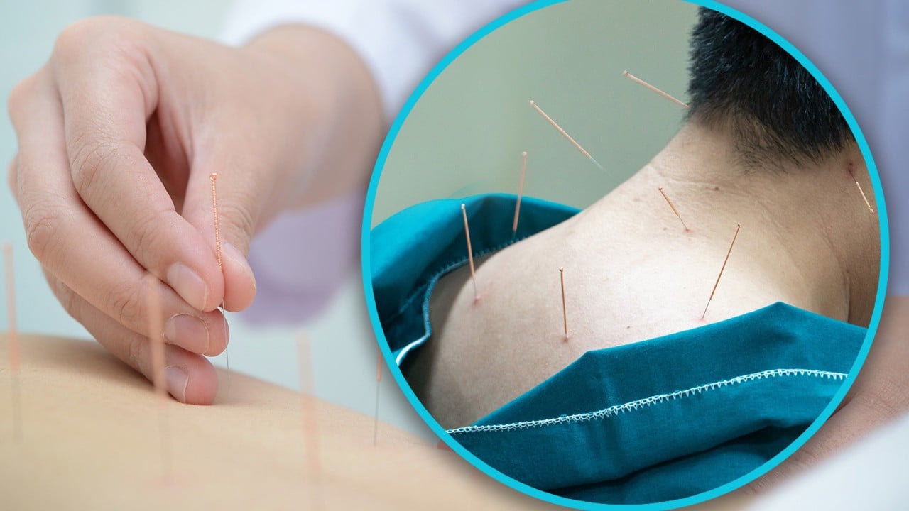 Chinese man visits cybercafe for acupuncture, ends up in ICU with punctured lungs