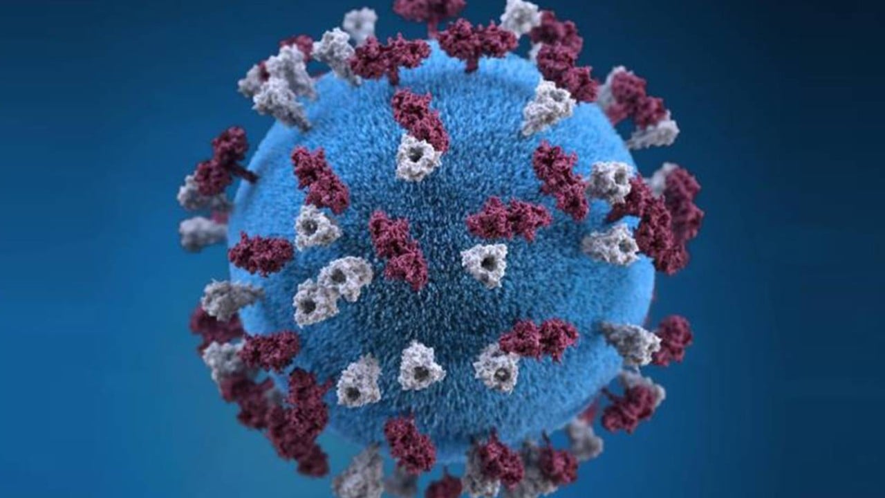 Measles roars back in the US, topping 1,000 cases