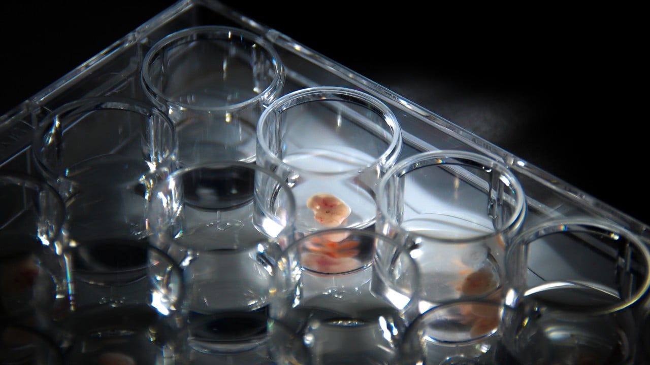 Digital embryo gives China a powerful tool to decode secret of life: scientists