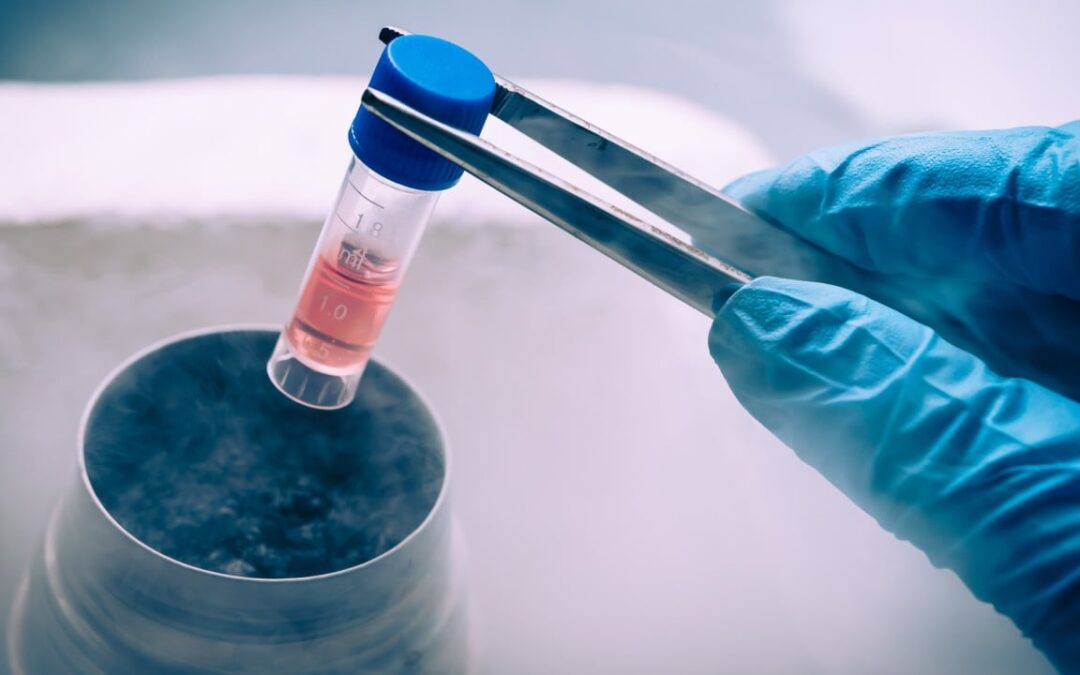 Chinese scientists develop promising stem cell therapy for Parkinson’s