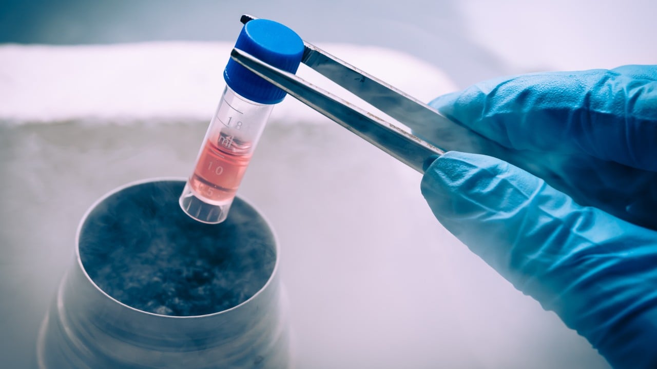 Chinese scientists develop promising stem cell therapy for Parkinson’s