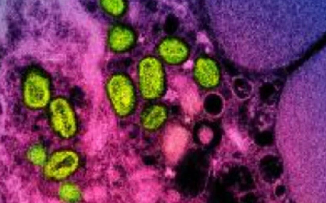 New mpox strain found in UK after travel to Asia