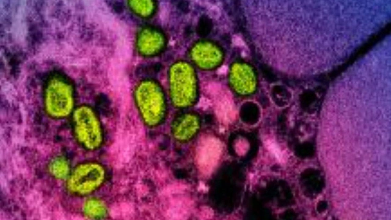 New mpox strain found in UK after travel to Asia