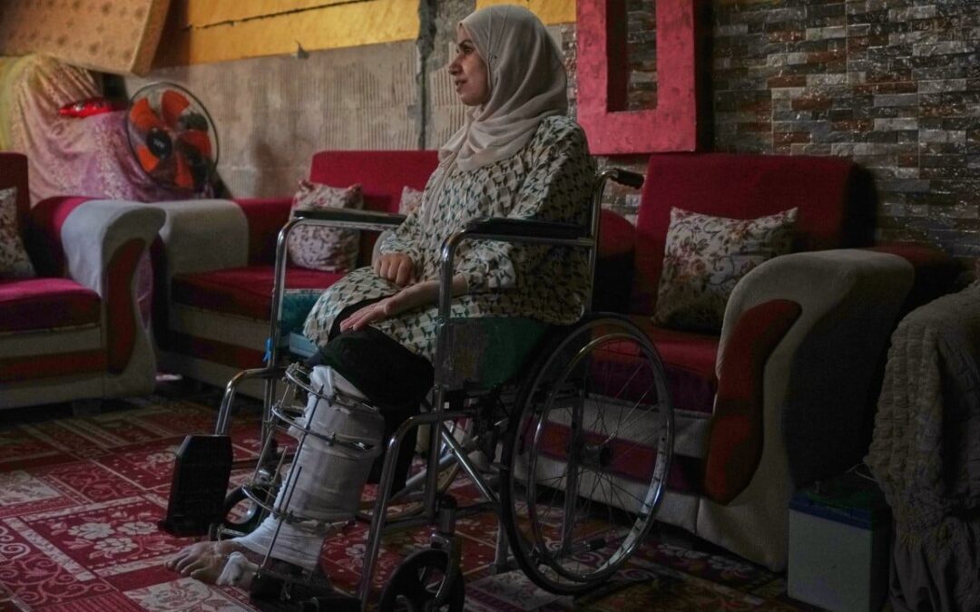 Gaza amputees desperate to walk again amid medical delays: ‘my future is paralysed’
