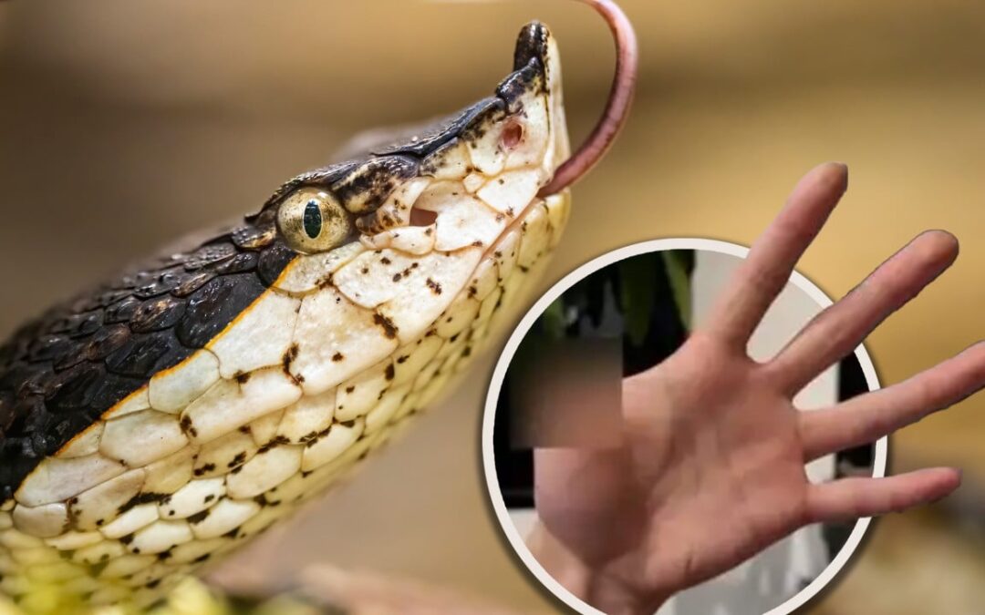 Chinese man hand-feeds pet snake, suffers serious bite, leads to thumb amputation