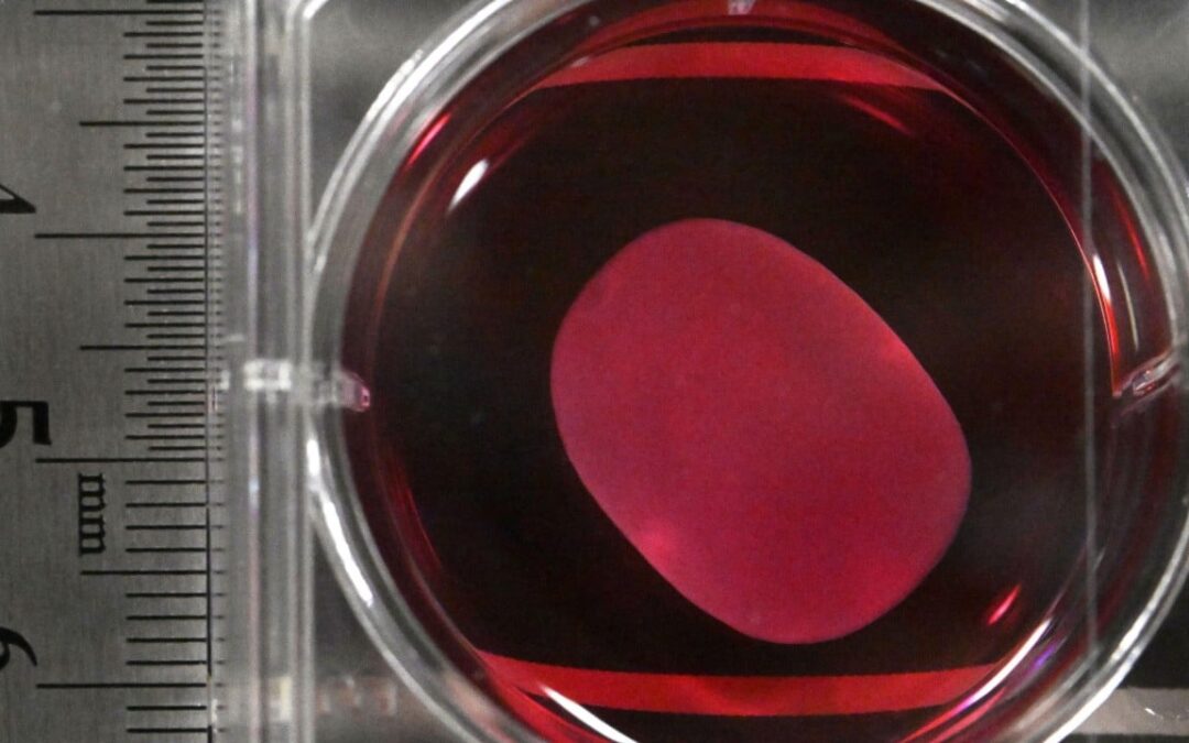 Japan approves world’s first regenerative medicines using iPS cells