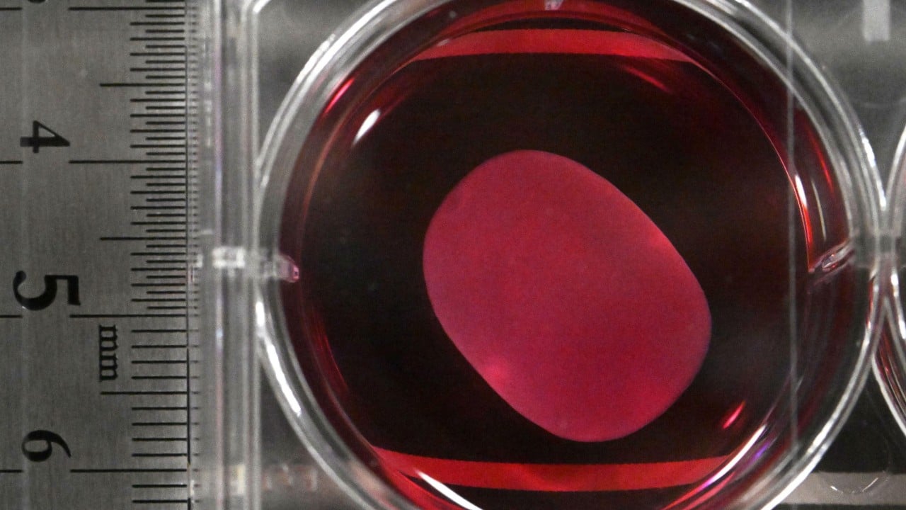 Japan approves world’s first regenerative medicines using iPS cells