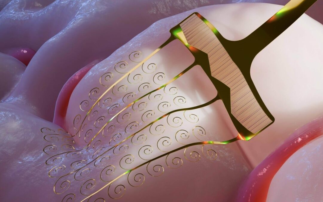 Japanese paper-cutting art inspires flexible brain implants in China