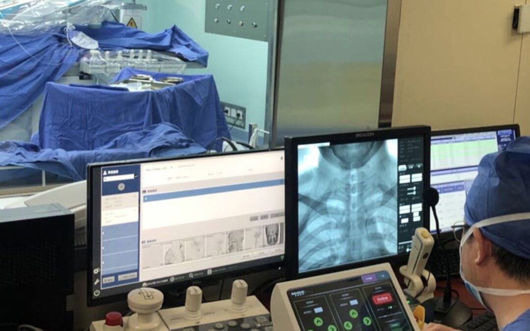 Chinese surgery robot outperforms humans, cuts brain imaging time by 29%