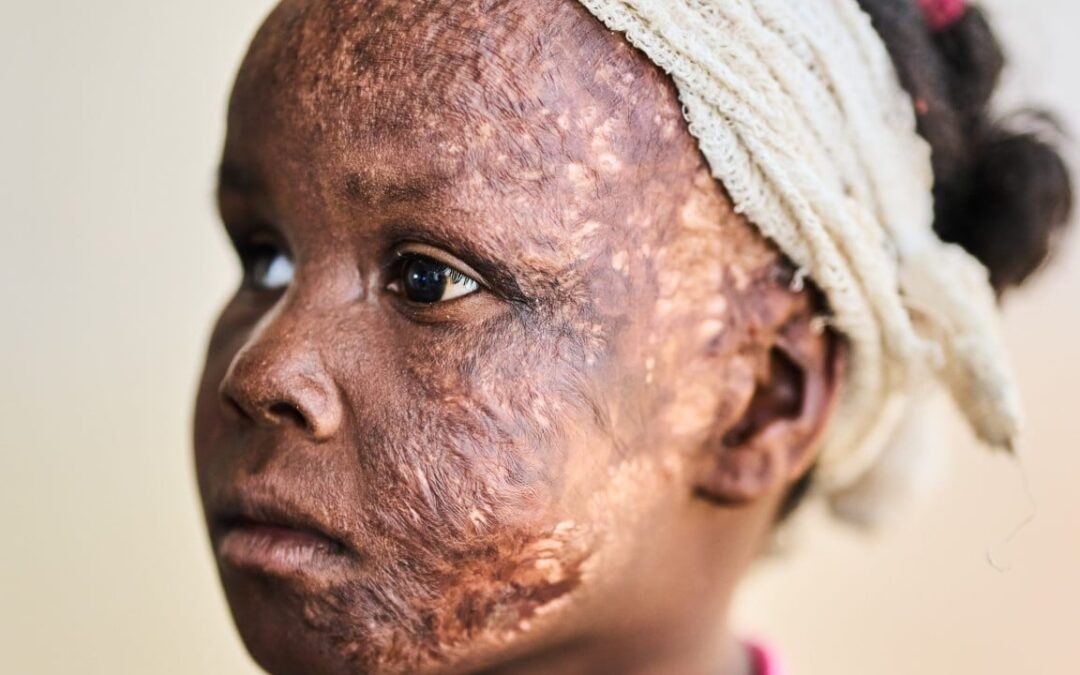Sudan’s RSF committed ethnic cleansing, says Amnesty