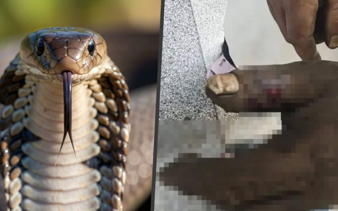 Chinese wife sucks venom from husband’s hand after cobra bite, ending up poisoning herself