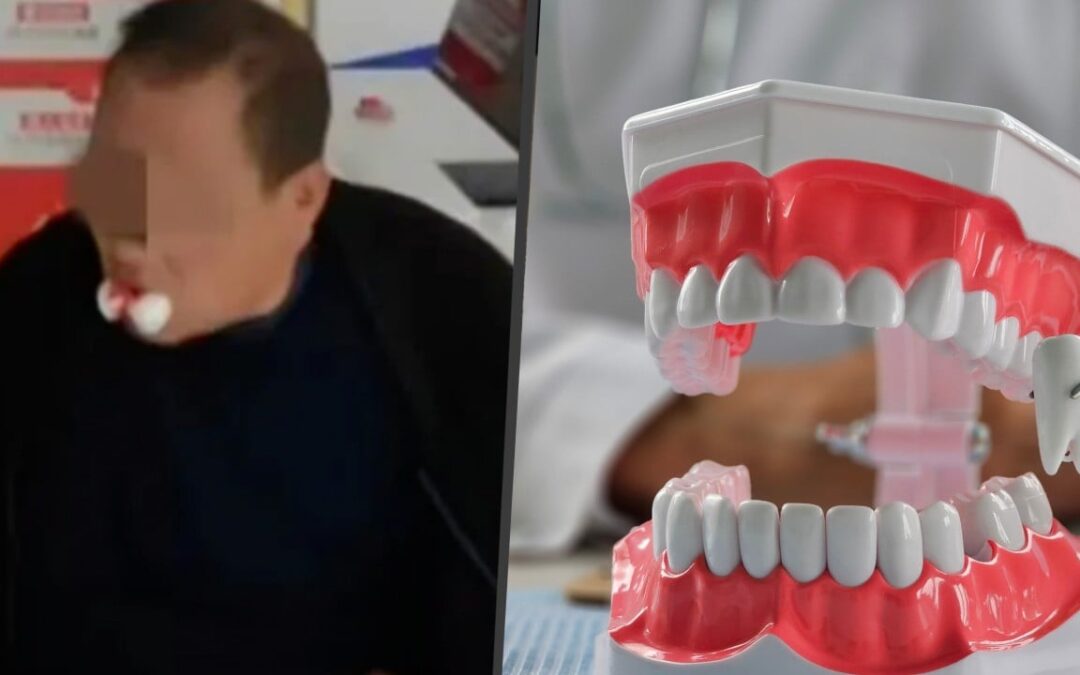 Chinese clinic extracts 12 teeth from man after he complains of ache in one tooth