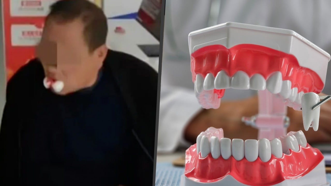 Chinese clinic extracts 12 teeth from man after he complains of ache in one tooth