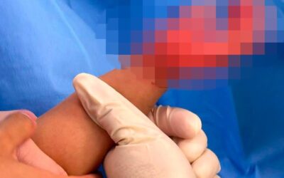 Domestic helper arrested after 1-year-old girl suffers burns in Hong Kong