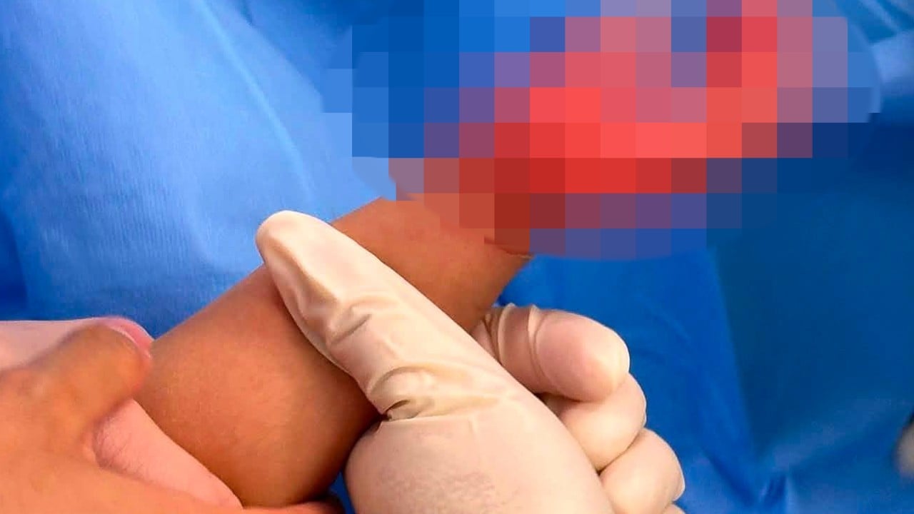 Domestic helper arrested after 1-year-old girl suffers burns in Hong Kong