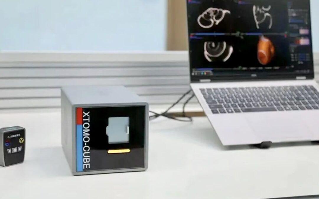Chinese scientists build world’s smallest CT scanner, weighing just 6kg