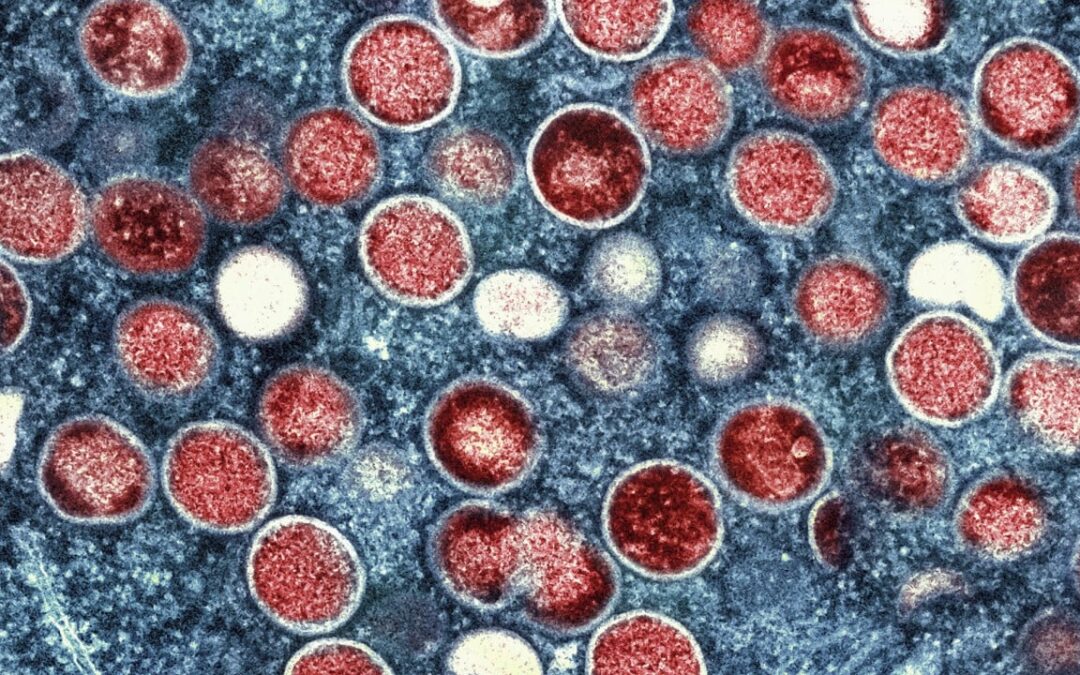 Hong Kong records 21 mpox cases since August, high-risk groups urged to get jabs